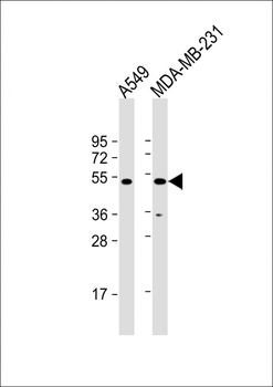 AADACL4 Antibody (C-Term)