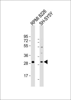 PPAPDC1B Antibody (Center)