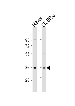 AKR7A3 Antibody (Center)