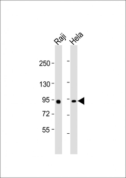 MYBL2 Antibody (Center)
