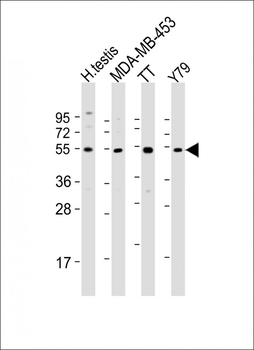 WDR51B Antibody (C-term)