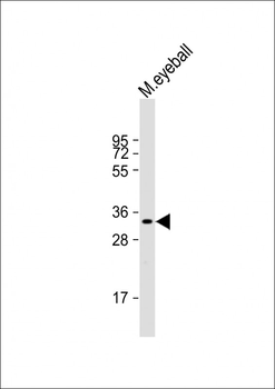 RLBP1 Antibody (C-term)