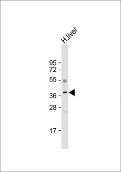 OR3A2 Antibody (C-term)