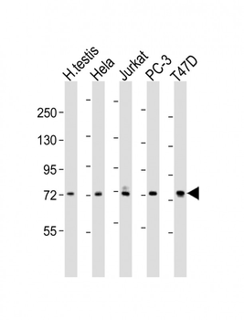 TNK1 Antibody (C-term)