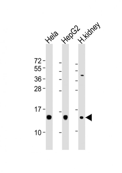 PFN1 Antibody (C-term)