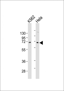ZNF257 Antibody (C-term)