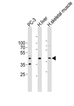 POC1A Antibody (C-term)