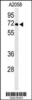 ATP6V1A Antibody (Center)