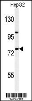 ZNF202 Antibody (Center)