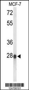 ABHDB Antibody (Center)