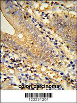 TSPAN33 Antibody (C-term)