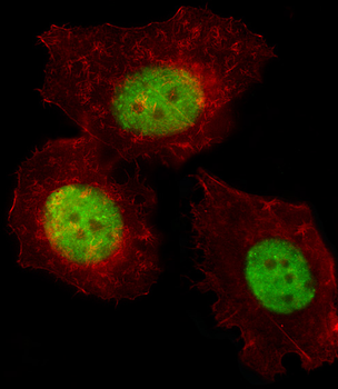 TREF1 Antibody (C-term)