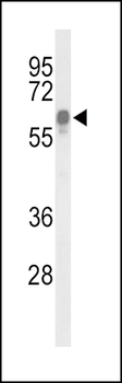 ITPKC Antibody (N-term)