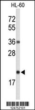 RNH2C Antibody (Center)