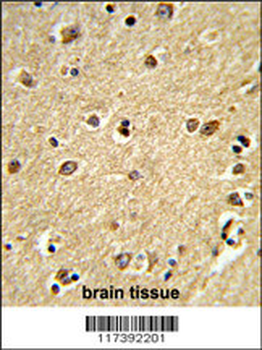 PLCB2 Antibody (N-term)