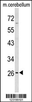 PXMP4 Antibody (Center)