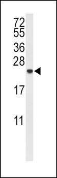 IL10 Antibody (Center)