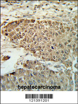 BIN3 Antibody (N-term)