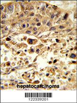 VPS26A Antibody (Center)