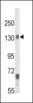 CACNA2D1 Antibody (N-term)
