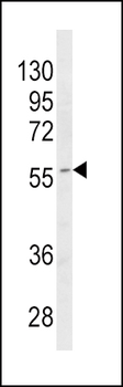 CYP4B1 Antibody (Center)