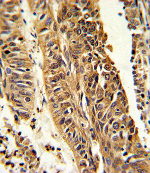 CYP4B1 Antibody (Center)