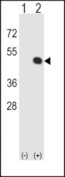 HLA-E Antibody (Center)