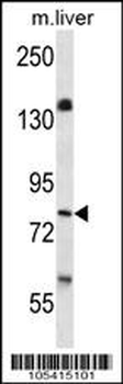 BRSK1 Antibody (C-term)