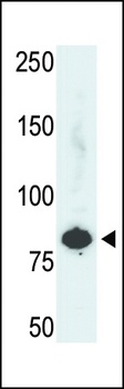 PFKL (L684) antibody