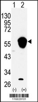 ALDH3A1 Antibody (N-term)