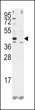 ALDH1A3 Antibody (Center)
