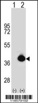 POLDIP2 Antibody (C-term)