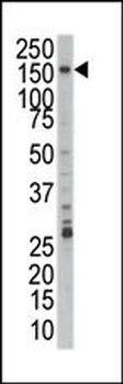 PRP4 Antibody (C-term)