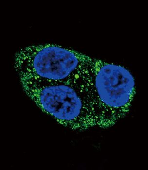 Tyrosinase Antibody (C-term)