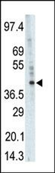 PHKG1 Antibody (Center)