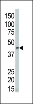 DAPK2 Antibody (N-term)