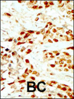 DAPK2 Antibody (N-term)
