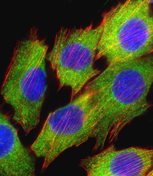 AKT2 Antibody (S474)