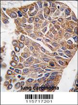 AKT2 Antibody (C-term)