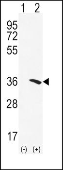 NAT2 Antibody (C-term)