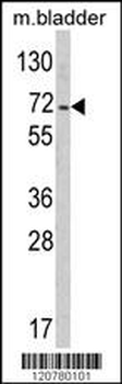 PTPN11 Antibody (C-term)