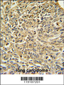 Merlin Antibody (N-term)