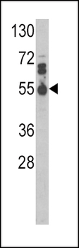 IL17RB Antibody (Center)