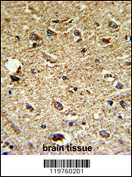 CCRN4L Antibody (C-term)