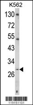 TRAP Antibody (C-term)