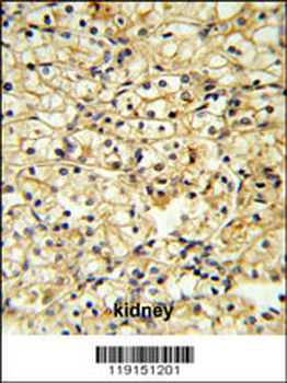 TRAP Antibody (C-term)