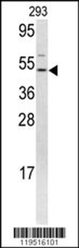 FLI1 Antibody (N-term K67)