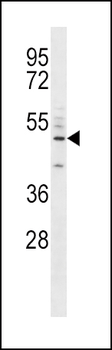 CD14 Antibody (C-term)
