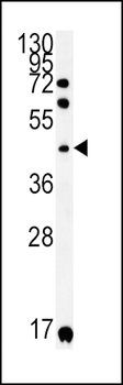 KIR2DS2 Antibody (Center)
