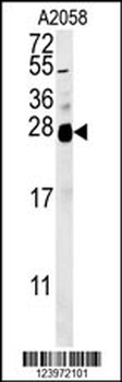 ZNF313 Antibody (C-term)